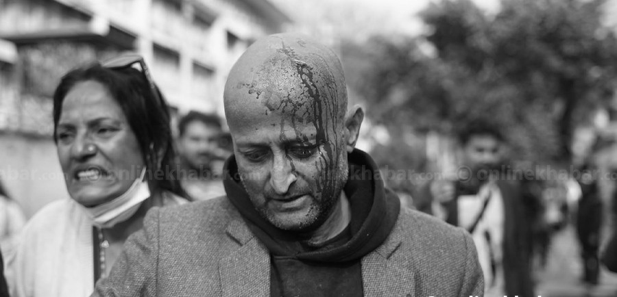 प्रहरीको लाठीचार्जपछि प्रदर्शनकारी घाइते, सिंहदरबार क्षेत्रमा कडा सुरक्षा