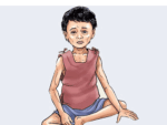 बालबालिकामा कुपोषण बढ्यो